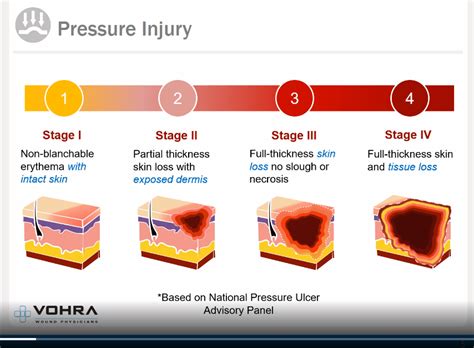 Acute And Chronic Wounds Vohra Wound Physicians