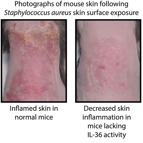 How The Skin Becomes Inflamed