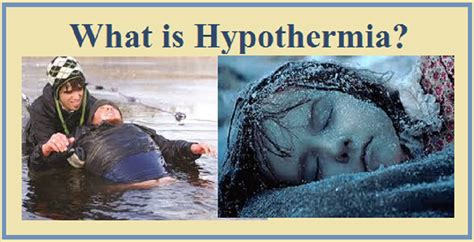 Hypothermia Hypothermia Facts Symptoms Stages Types And Treatment Factdr Hypothermia Is A