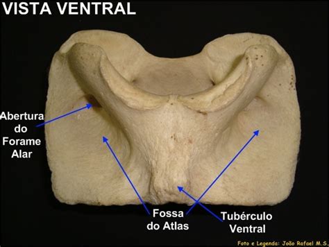 Medicina Veterinária Unipac Osteologia Veterinária Esqueleto Axial