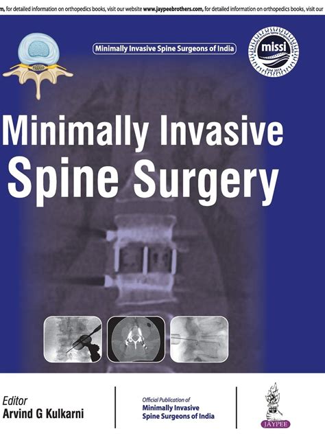 Minimally Invasive Spine Surgery Official Publication Of Minimally