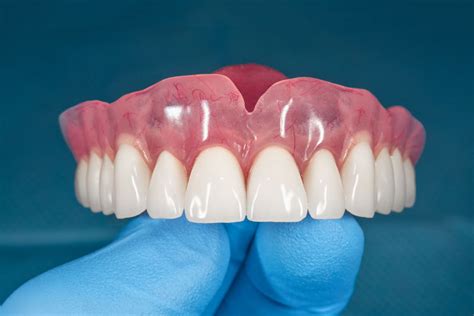 Fixed Vs Removable Teeth Charlotte Denture Stabilization