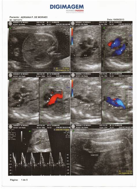 Diário Da Minha Gravidez Ultrassom