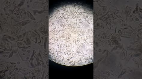 Trichomonas Vaginalis Hvs Wet Preparation Under X10 Microscope Youtube