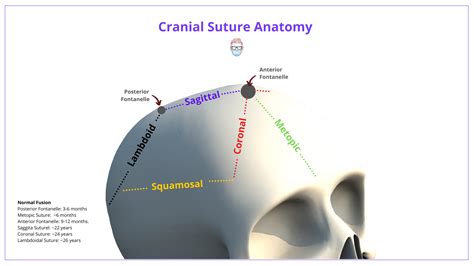 Craniosynostosis Definition Clinical Features Drawings