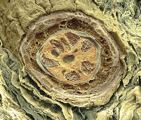 Hair Follicle Sem Photograph By Science Photo Library Pixels