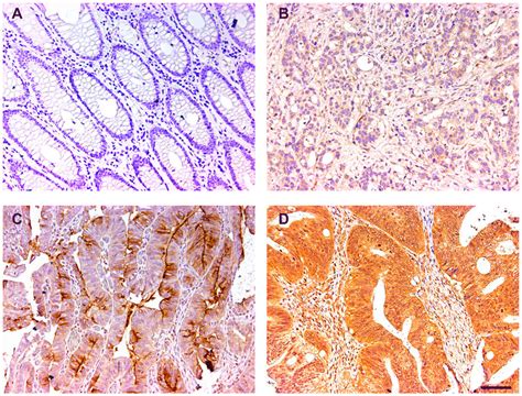 Representative Immunohistochemical Images Of The Cst1 Expression A