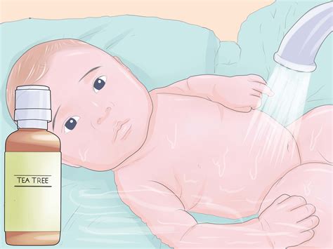 Eurerin baby eczema cream is a gentle formula that can be used when needed. 4 Ways to Treat Infant Eczema Naturally - wikiHow