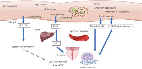 Gut Microbiome And Prostate Cancer Fujita 2022 International