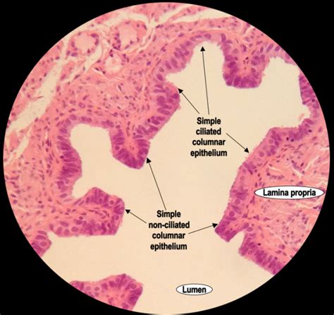 Microscope Labeled Simple Columnar Epithelium Micropedia