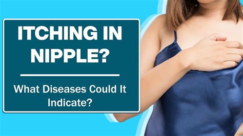 Itching In Nipple What Diseases Could It Indicate Cure 91