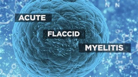 Understand Acute Flaccid Myelitis And Its Symptoms