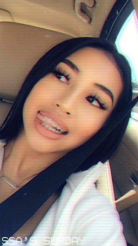 Hot Girls With Braces Telegraph