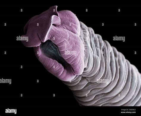 Coloured Scanning Electronmicrograph Sem Of A Tapeworm Eubothrium