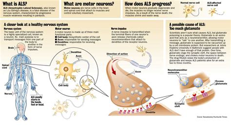 Amyotrophic lateral sclerosis (als) is the most common degenerative disease of the motor neuron system. WHAT IS ALS & #ICEBUCKETCHALLENGE? | GLOBALIZM