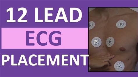12 Lead Ecg Placement Of Electrodes Ekg Sticker Lead Procedure สรุป
