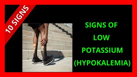 10 signs of low potassium symptoms and causes youtube