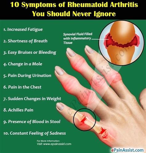 What Are The Symptoms Of Viral Arthritis