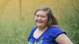 Trisomy 21 (down syndrome) is the most common autosomal trisomy in newborns, and is strongly associated with increasing maternal age. Trisomy 21: Kate's Story | Children's Hospital of Philadelphia