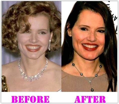 Geena Davis Plastic Surgery Before And After Plastic Surgery Geena