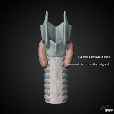Parathyroid Gland Illustration Radiology Case