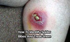 Identify and treat black widow spider bites. 31 Best webs & spiders images | Spider, Insects, Beautiful ...
