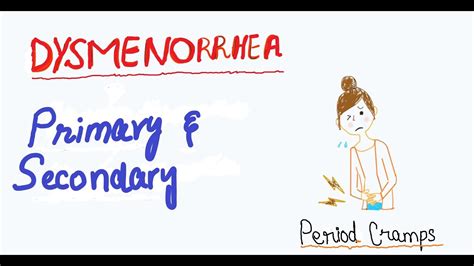 Dysmenorrhea Painful Periods Gynecology And Obstetrics Nerves