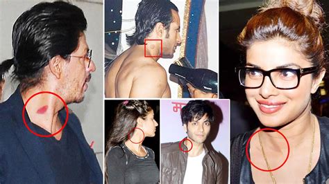 10 Bollywood Celebrities Who Were Snapped With Hickeys And Love Bites