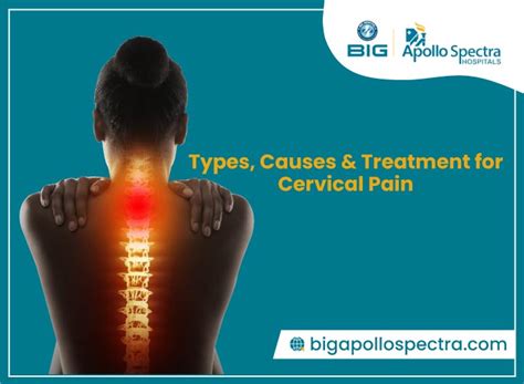 Cervical Pain Types Causes And Treatment