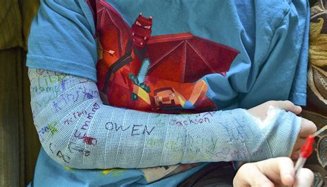 Signed Arm Cast