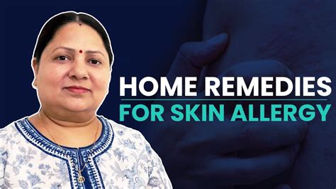 Skin Allergy Home Remedies 100 Effective Youtube