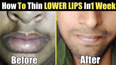 How To Thin LOWER LIPS Naturally At Home Get Slim Lips Naturally