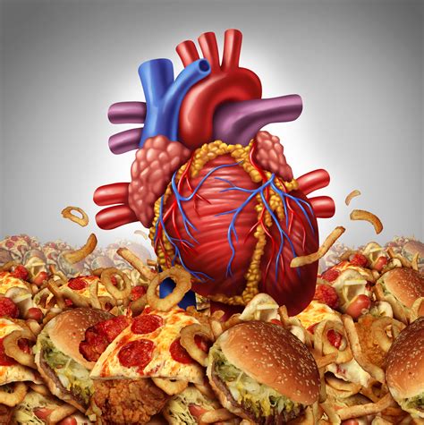 Learn about causes and symptoms of coronary heart disease, how it is treated, and nhlbi research. Obese People Sometimes Protected Against Diabetes, Heart ...