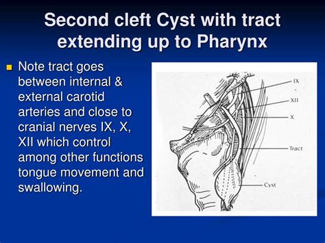 Ppt Branchial Cleft Cyst Powerpoint Presentation Id 261469