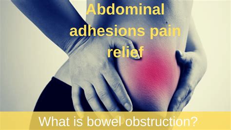 Abdominal Adhesions Pain Relief What Is Bowel Obstruction Youtube