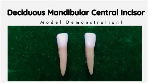 Deciduous Mandibular Central Incisor Tooth Morphology Youtube