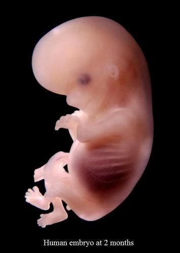 Picture Of Embryo In The 2nd Month