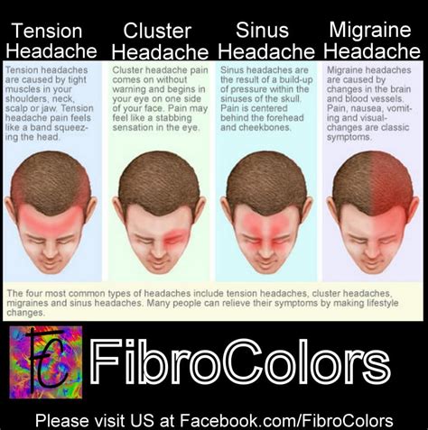Headaches Focus On Cluster Migraine And Tension Natural Migraine