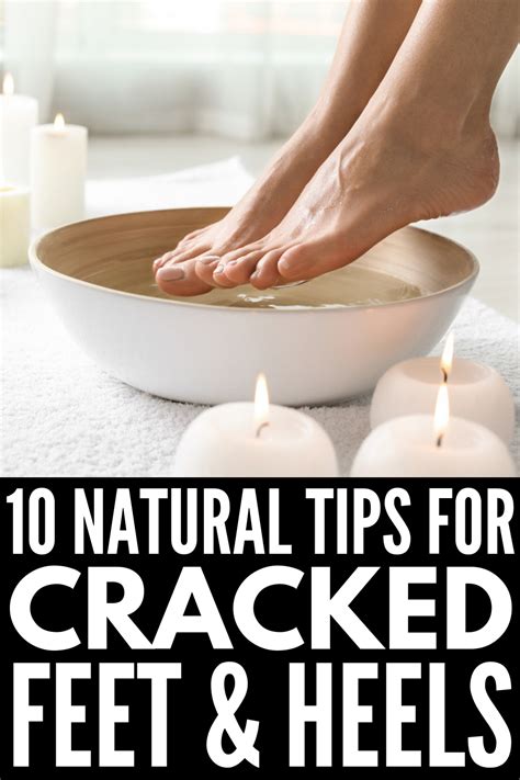 6 Home Remedies For Cracked Heels That Actually Work Artofit