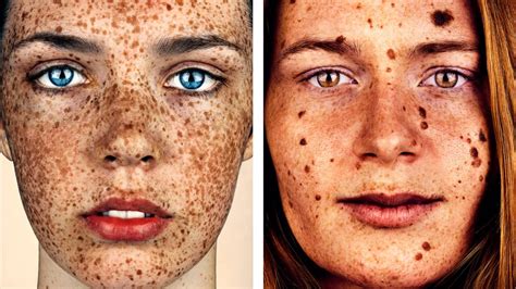 These Photos Will Make You Love Your Freckles Bbc Three