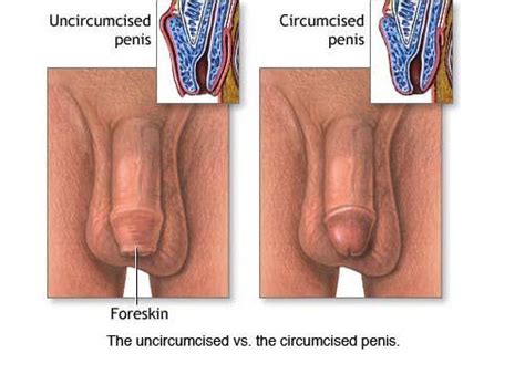 Why Adult Men Are Getting Circumcised Daily Squirt