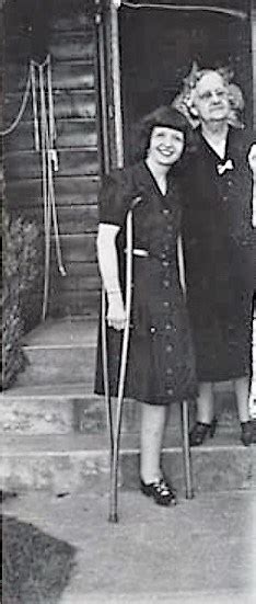 Leg Amputee Woman Crutches One