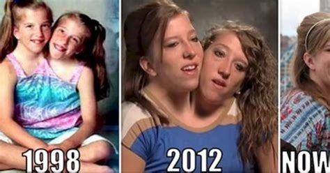 Fascinating Facts About Famous Conjoined Twins Abby And Brittany Hensel Porn Sex Picture