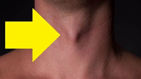 How To Get A Bigger Adams Apple Fast Youtube