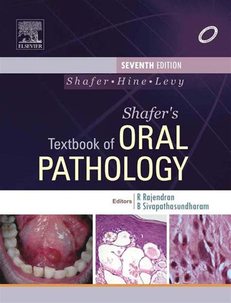 Pin On Oral Pathology