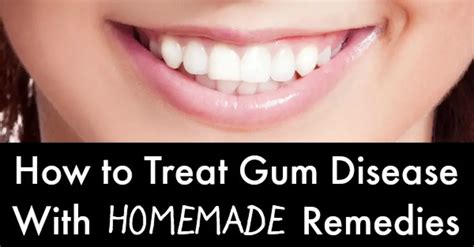 How To Get Rid Of Gum Disease Naturally Archives Health Positive