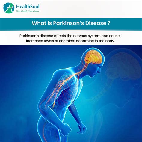 parkinson s disease symptoms diagnosis and treatment healthsoul