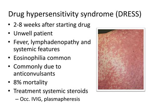 Drug Hypersensitivity Syndrome