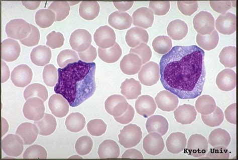 Lymphocyte