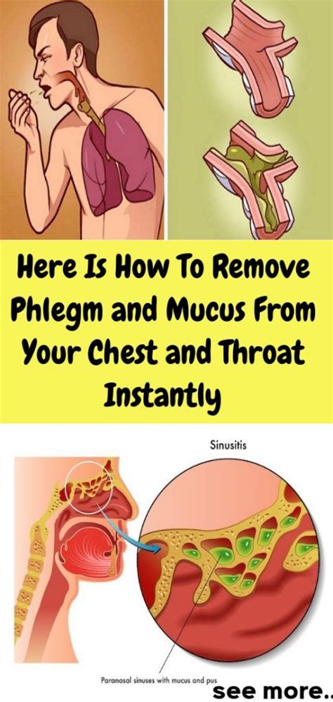 Here Is How To Remove Phlegm And Mucus From Your Chest And Throat